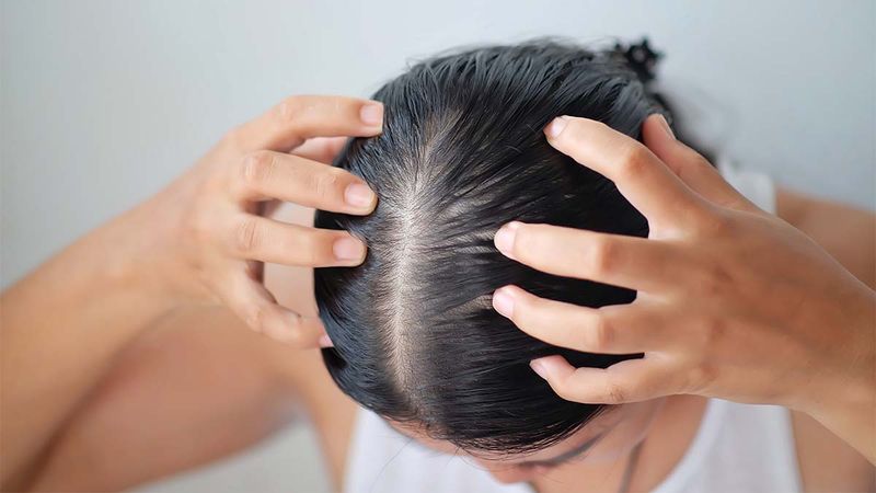 Stimulates Hair Growth