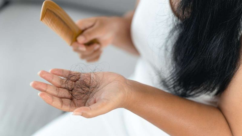Hair Loss