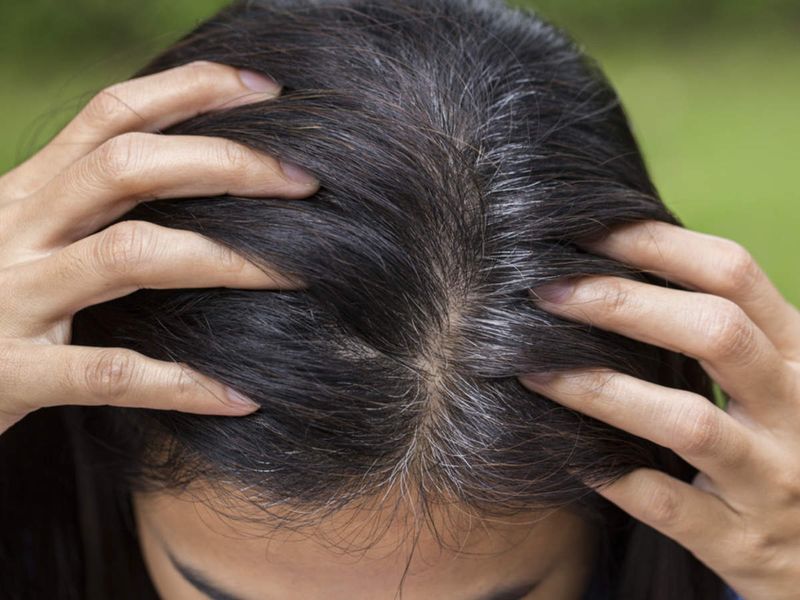 Ignoring Hair Scalp Care