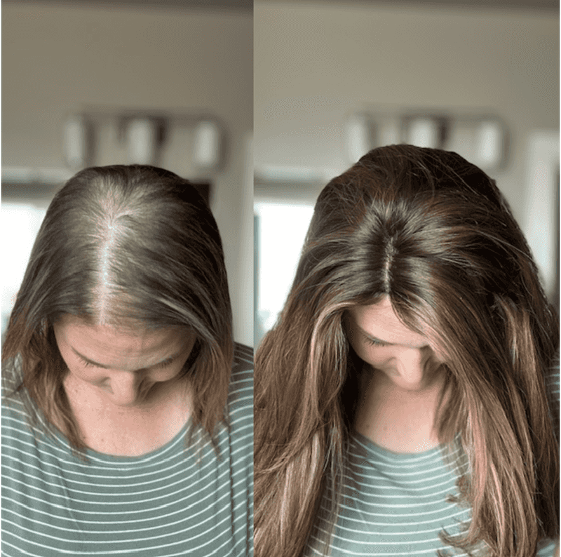 Mistake 2: Overlooking Hairline
