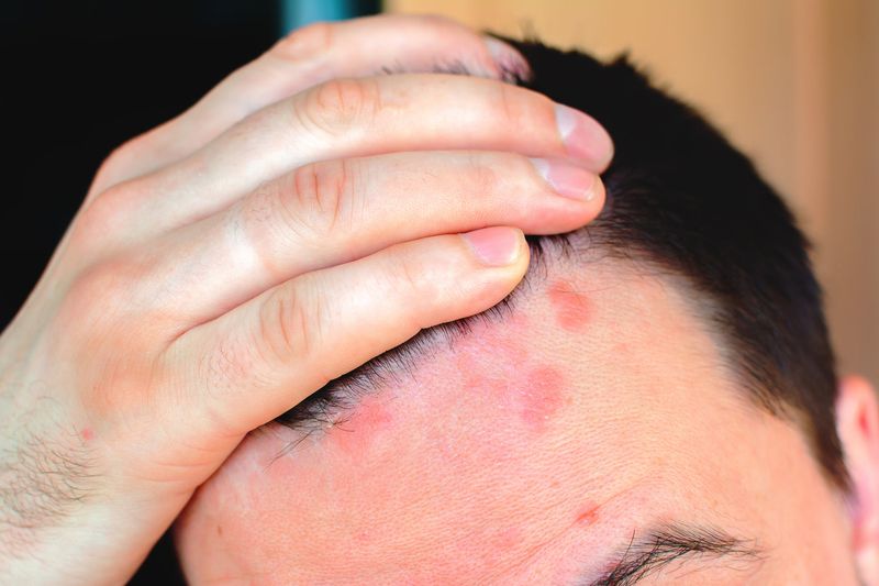 Ignoring Scalp Health