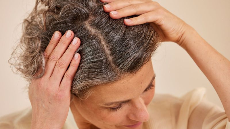 Neglecting Scalp Health
