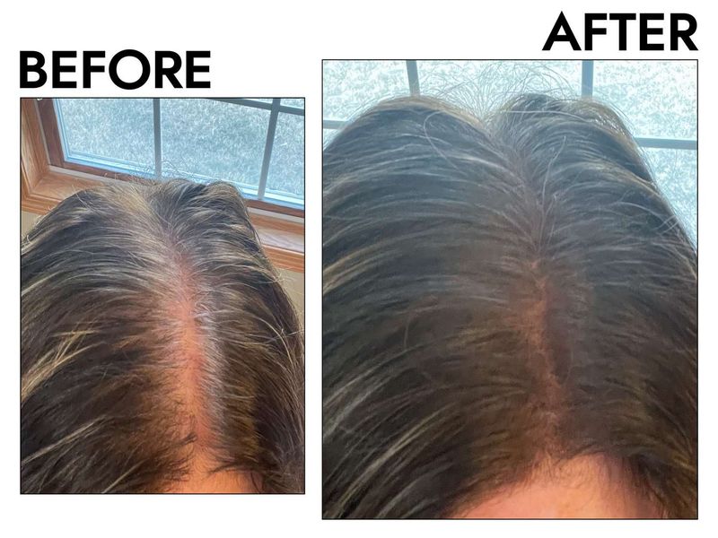 Patchy Gray Coverage
