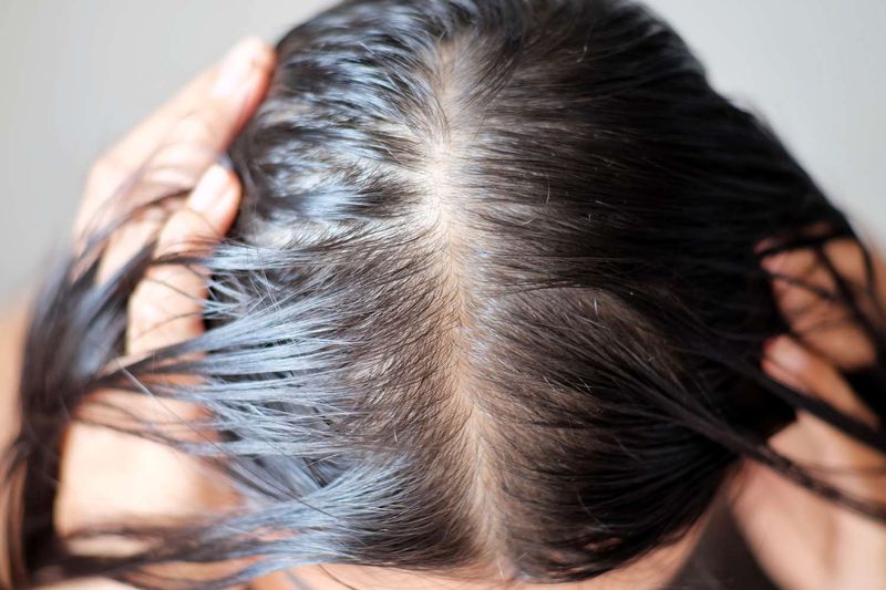 Thinning Strands
