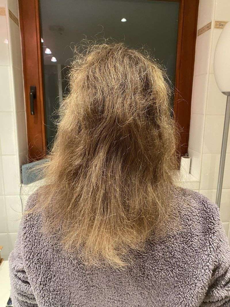 5 Common Mistakes: Ignoring Hair Health