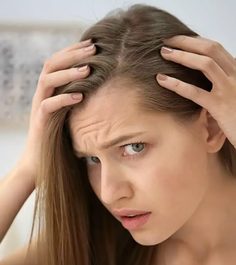 Altered Hairline