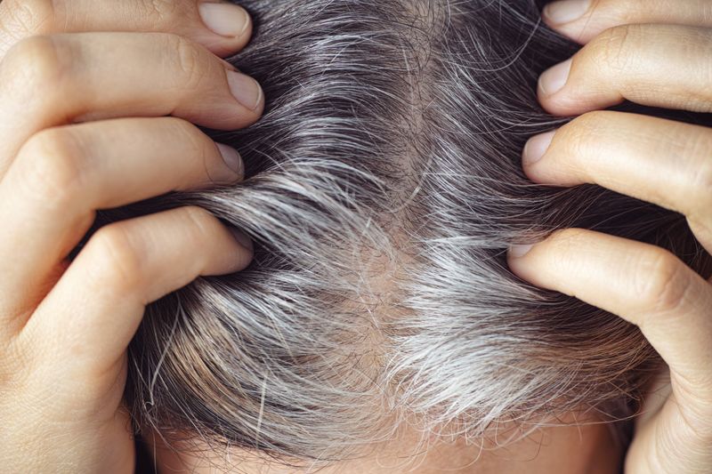 Ignoring Scalp Health