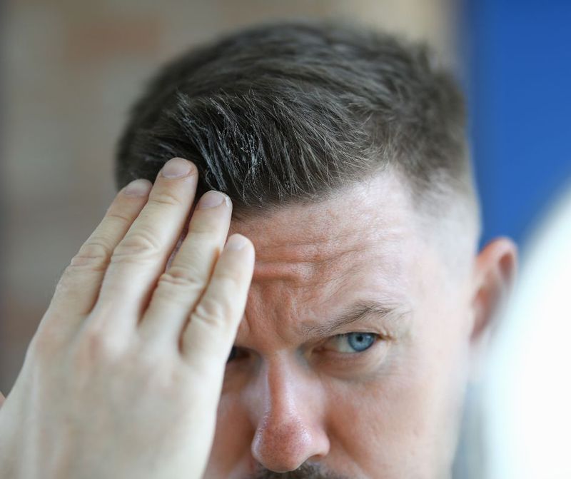 Overusing Hair Gel