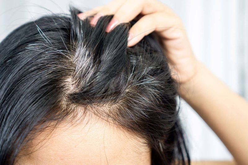 Scalp Sensitivity